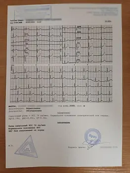 Купить заключение ЭКГ